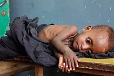 Malnutrition as a Leadership Challenge