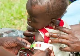 Malnutrition Costs Ghana Billions. Why is it Not Treated as an Economic Emergency?